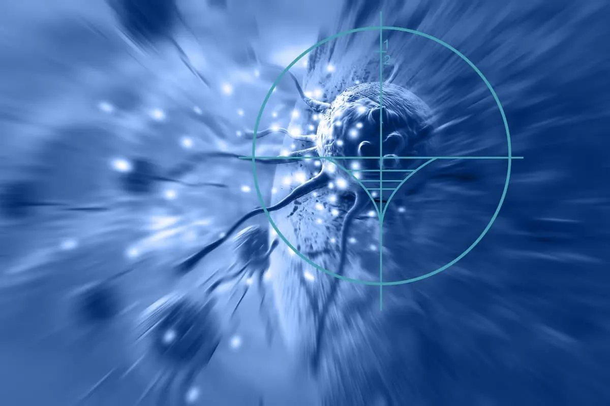 Un nouvel implant radioactif s'attaque aux tumeurs cancéreuses avec un succès remarquable