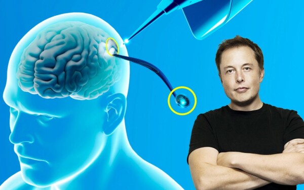 Neuralink, la startup d'Elon Musk, recherche des humains pour tester sa puce cérébrale, ça vous tente ?